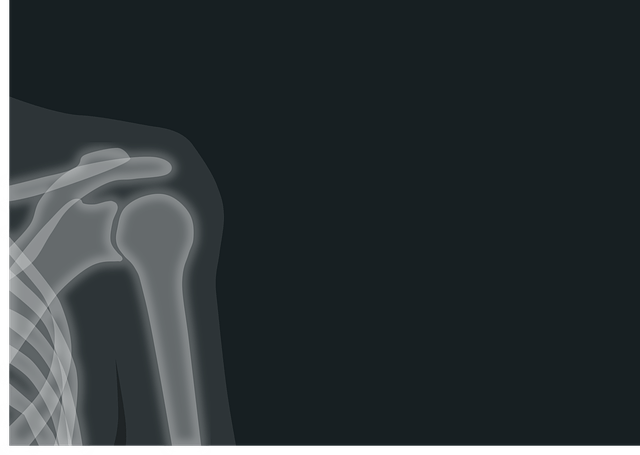 Addressing Shoulder Pain in Houston
